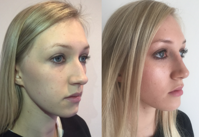 I would use CosMediTour again in the future!